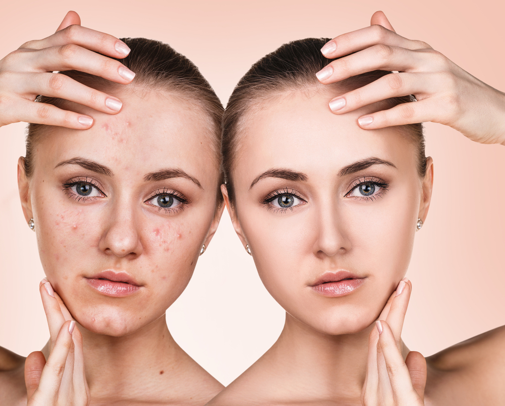 10 skin retouching photoshop tutorials- rephotosolution.com